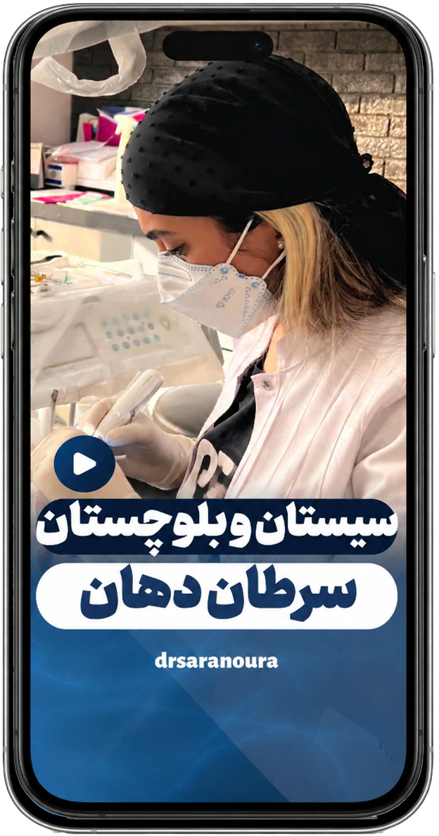 cover3